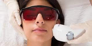 Laser Hair Removal Treatment