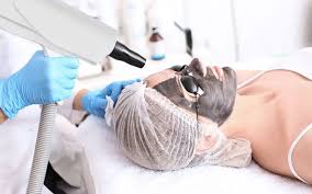 Carbon Laser Facial Treatment in Guntur